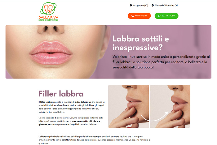 Sito di Dalla Riva Filler